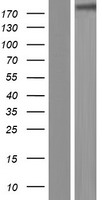 Western blot validation of overexpression lysate (Cat# LY414724) using anti-DDK antibody (Cat# TA50011-100). Left: Cell lysates from un-transfected HEK293T cells; Right: Cell lysates from HEK293T cells transfected with RC220412 using transfection reagent MegaTran 2.0 (Cat# TT210002).