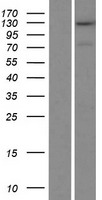 Western blot validation of overexpression lysate (Cat# LY411873) using anti-DDK antibody (Cat# <a href = "https://www.origene.com/catalog/antibodies/tag-antibodies/ta50011-100-clone-oti4c5-anti-ddk-flag-monoclonal-antibody" title="TA50011-100" class="">TA50011-100</a>). Left: Cell lysates from un-transfected HEK293T cells; Right: Cell lysates from HEK293T cells transfected with <a href = "https://www.origene.com/catalog/cdna-clones/expression-plasmids/rc212673-trappc11-nm-021942-human-tagged-orf-clone" title="RC212673" class="">RC212673</a> using transfection reagent MegaTran 2.0 (Cat# <a href = "https://www.origene.com/catalog/others/transfection-reagents/tt210002-megatran-20-plasmid-dna-transfection-reagent-05-ml" title="TT210002" class="">TT210002</a>).