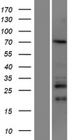 Western blot validation of overexpression lysate (Cat# LY405738) using anti-DDK antibody (Cat# <a href = "https://www.origene.com/catalog/antibodies/tag-antibodies/ta50011-100-clone-oti4c5-anti-ddk-flag-monoclonal-antibody" title="TA50011-100" class="">TA50011-100</a>). Left: Cell lysates from un-transfected HEK293T cells; Right: Cell lysates from HEK293T cells transfected with <a href = "https://www.origene.com/catalog/cdna-clones/expression-plasmids/rc211648-ccdc67-deup1-nm-181645-human-tagged-orf-clone" title="RC211648" class="">RC211648</a> using transfection reagent MegaTran 2.0 (Cat# <a href = "https://www.origene.com/catalog/others/transfection-reagents/tt210002-megatran-20-plasmid-dna-transfection-reagent-05-ml" title="TT210002" class="">TT210002</a>).
