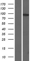Western blot validation of overexpression lysate (Cat# LY405477) using anti-DDK antibody (Cat# TA50011-100). Left: Cell lysates from un-transfected HEK293T cells; Right: Cell lysates from HEK293T cells transfected with RC215385 using transfection reagent MegaTran 2.0 (Cat# TT210002). Western blot validation of overexpression lysate (Cat# LY405477) using anti-DDK antibody (Cat# TA50011-100). Left: Cell lysates from un-transfected HEK293T cells; Right: Cell lysates from HEK293T cells transfected with RC215385 using transfection reagent MegaTran 2.0 (Cat# TT210002).