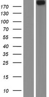 Western blot validation of overexpression lysate (Cat# LY412451) using anti-DDK antibody (Cat# TA50011-100). Left: Cell lysates from un-transfected HEK293T cells; Right: Cell lysates from HEK293T cells transfected with RC214825 using transfection reagent MegaTran 2.0 (Cat# TT210002).