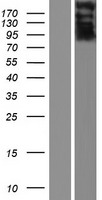 Western blot validation of overexpression lysate (Cat# LY431657) using anti-DDK antibody (Cat# TA50011-100). Left: Cell lysates from un-transfected HEK293T cells; Right: Cell lysates from HEK293T cells transfected with RC228629 using transfection reagent MegaTran 2.0 (Cat# TT210002). Western blot validation of overexpression lysate (Cat# LY431657) using anti-DDK antibody (Cat# TA50011-100). Left: Cell lysates from un-transfected HEK293T cells; Right: Cell lysates from HEK293T cells transfected with RC228629 using transfection reagent MegaTran 2.0 (Cat# TT210002).