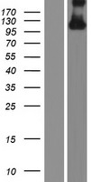 Western blot validation of overexpression lysate (Cat# LY413702) using anti-DDK antibody (Cat# TA50011-100). Left: Cell lysates from un-transfected HEK293T cells; Right: Cell lysates from HEK293T cells transfected with RC221325 using transfection reagent MegaTran 2.0 (Cat# TT210002).