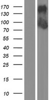 Western blot validation of overexpression lysate (Cat# <a href = "https://www.origene.com/catalog/proteins/over-expression-lysates/ly420444-dzank1-nm-001099407-human-over-expression-lysate" title="LY420444" class="">LY420444</a>) using anti-DDK antibody (Cat# <a href = "https://www.origene.com/catalog/antibodies/tag-antibodies/ta50011-100-clone-oti4c5-anti-ddk-flag-monoclonal-antibody" title="TA50011-100" class="">TA50011-100</a>). Left: Cell lysates from un-transfected HEK293T cells; Right: Cell lysates from HEK293T cells transfected with <a href = "https://www.origene.com/catalog/cdna-clones/expression-plasmids/rc212706-dzank1-nm-001099407-human-tagged-orf-clone" title="RC212706" class="">RC212706</a> using transfection reagent MegaTran 2.0 (Cat# <a href = "https://www.origene.com/catalog/others/transfection-reagents/tt210002-megatran-20-plasmid-dna-transfection-reagent-05-ml" title="TT210002" class="">TT210002</a>).