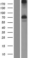 Western blot validation of overexpression lysate (Cat# LY408611) using anti-DDK antibody (Cat# <a href="https://www.origene.com/catalog/antibodies/tag-antibodies/ta50011-100-clone-oti4c5-anti-ddk-flag-monoclonal-antibody" title="TA50011-100" class="">TA50011-100</a>). Left: Cell lysates from un-transfected HEK293T cells; Right: Cell lysates from HEK293T cells transfected with <a href="https://www.origene.com/catalog/cdna-clones/expression-plasmids/rc206320-kiaa2013-nm-138346-human-tagged-orf-clone" title="RC206320" class="">RC206320</a> using transfection reagent MegaTran 2.0 (Cat# <a href="https://www.origene.com/catalog/others/transfection-reagents/tt210002-megatran-20-plasmid-dna-transfection-reagent-05-ml" title="TT210002" class="">TT210002</a>).