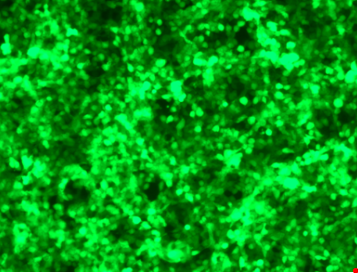 Data image of AAVDJ-CMV-GFP Control Particle.