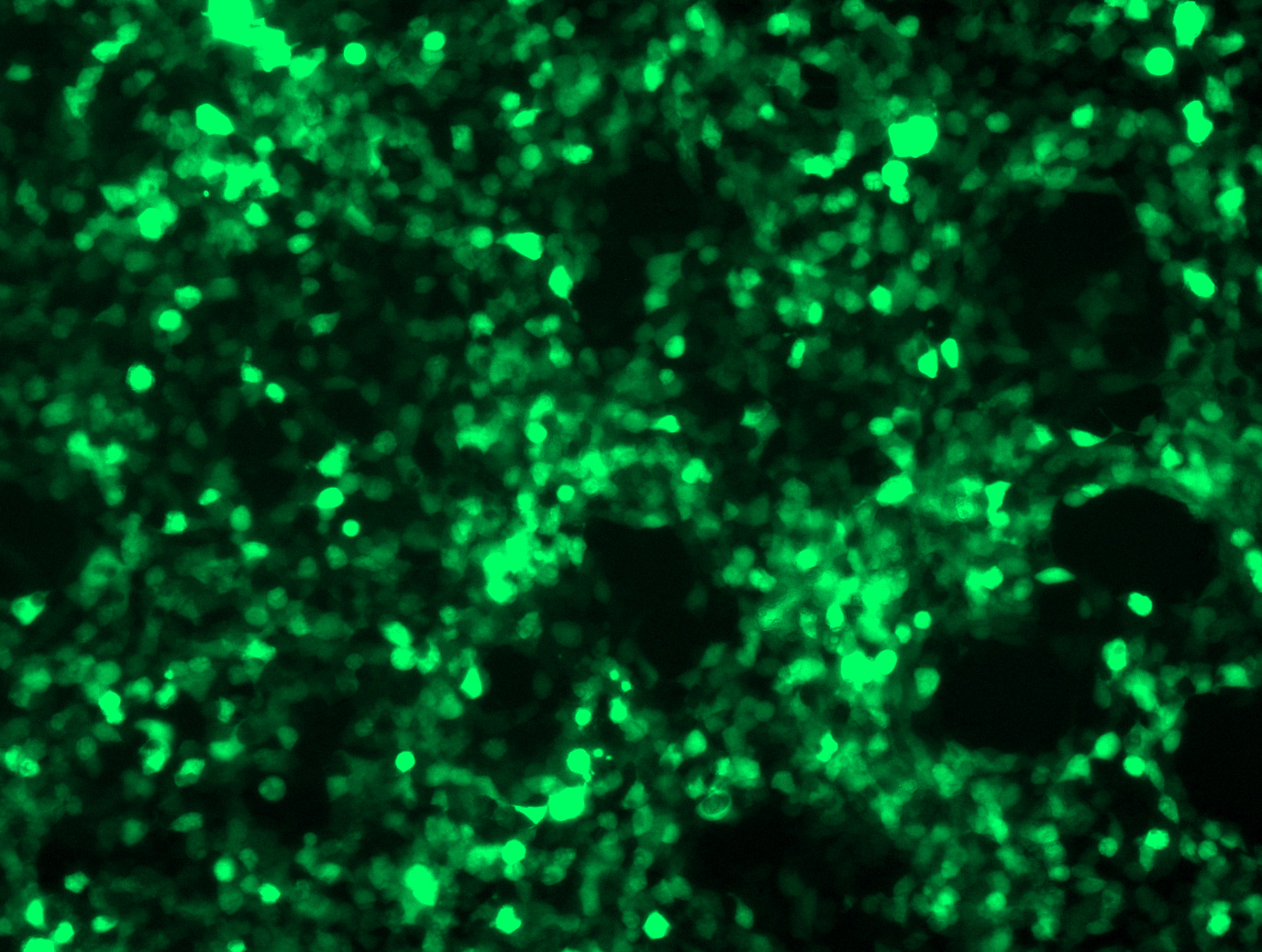 AAV-MyoAAV 1A Scrambled shRNA Control Particle
