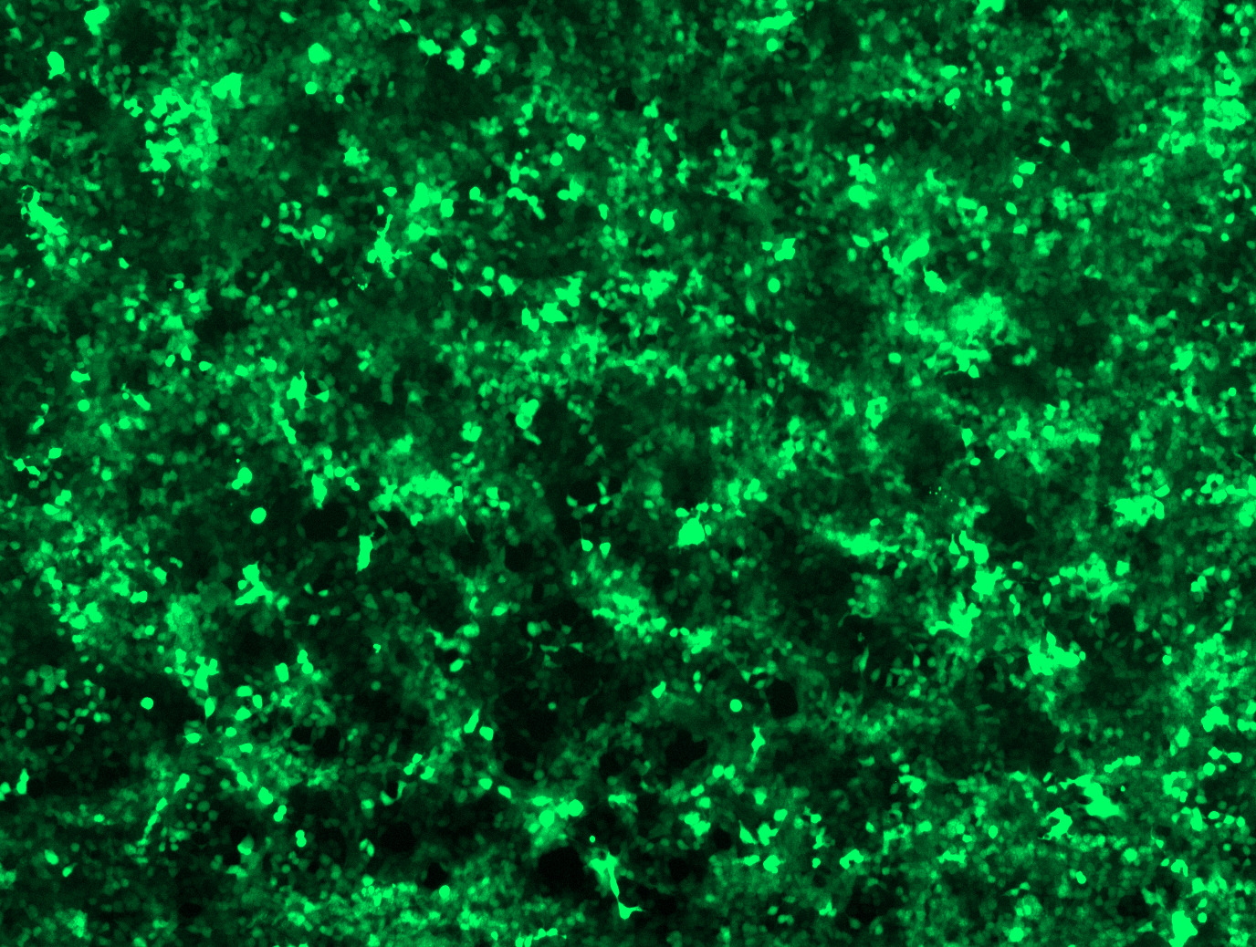 Data image of MyoAAV 2A-CMV-GFP Control Particle.