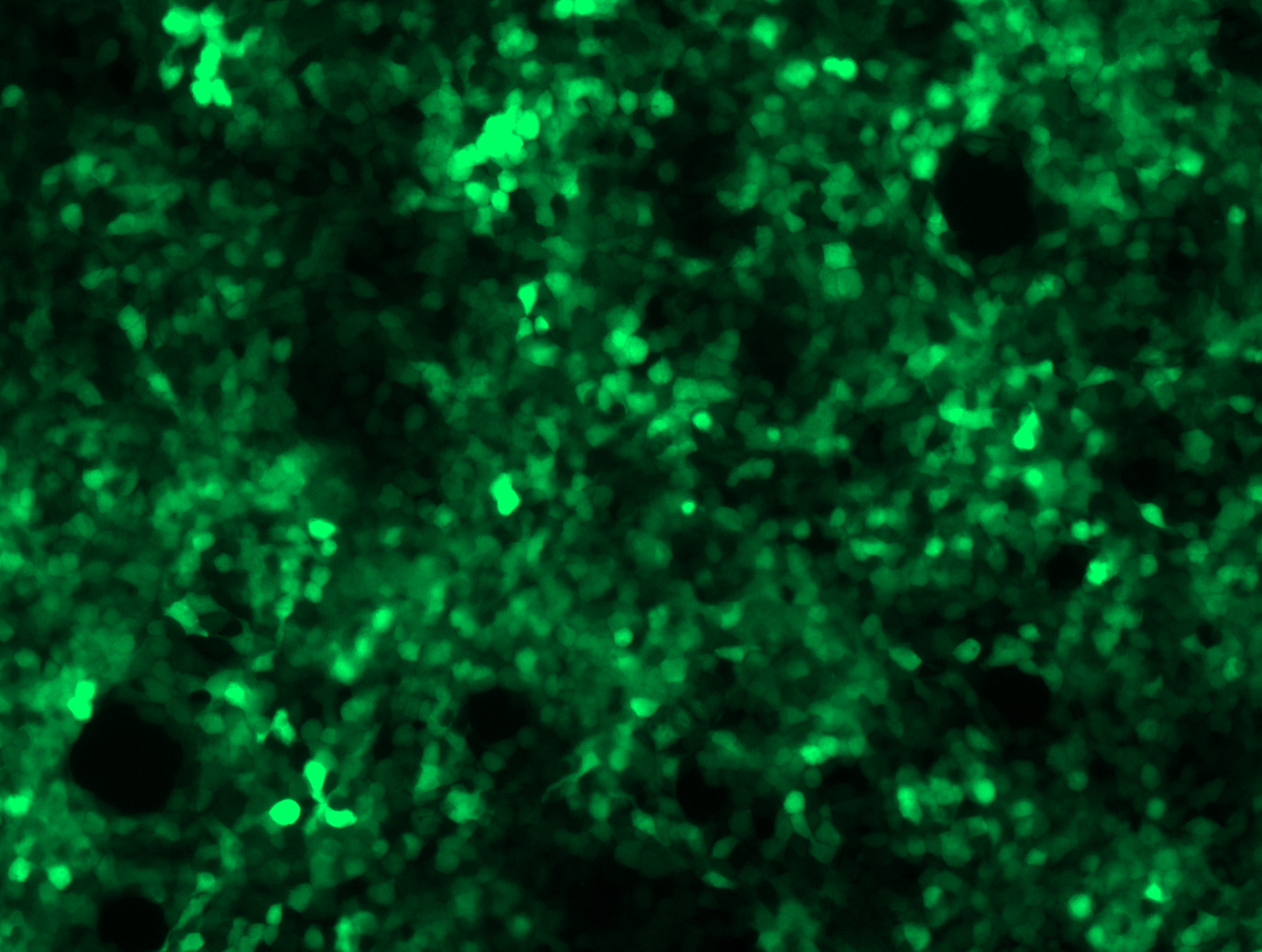 AAVrh.74-CMV-GFP Control Particle