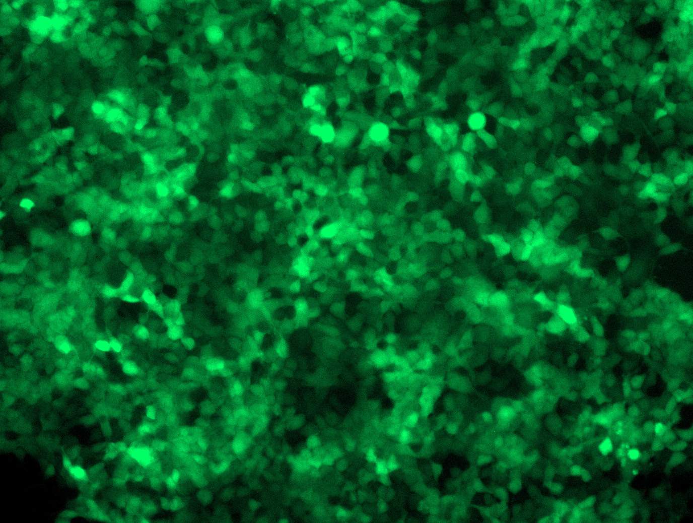 Lentiviral Control Particles