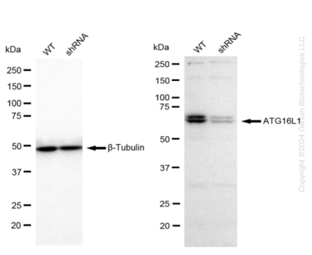 ATG16L1 Human Knockdown Lysate