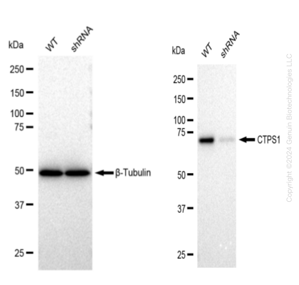 CTP synthase (CTPS1) Human Knockdown Lysate