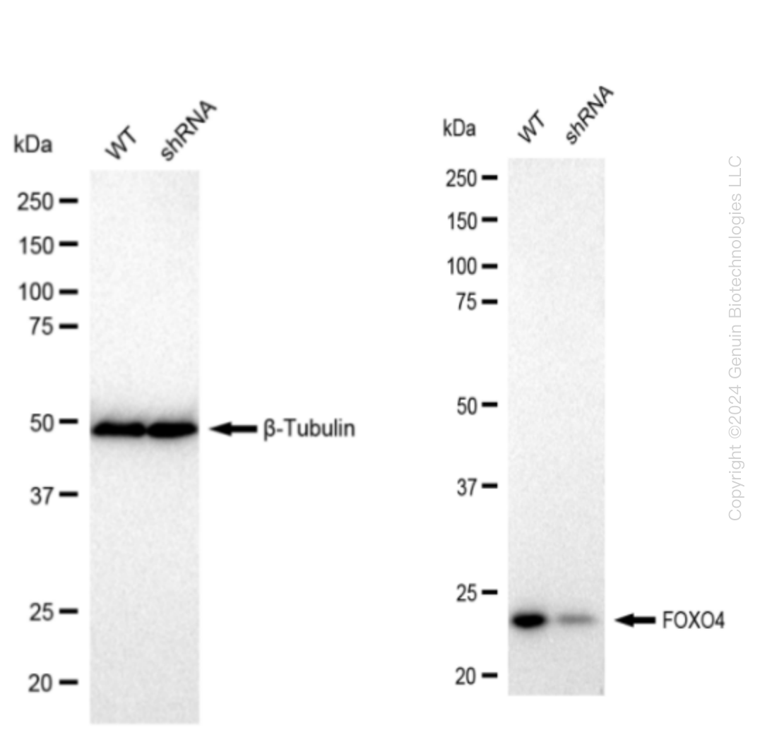 FOXO4 Human Knockdown Lysate