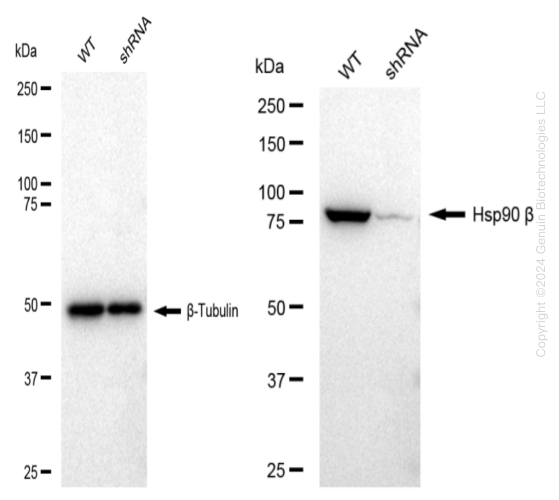 HSP90AB1 Human Knockdown Lysate
