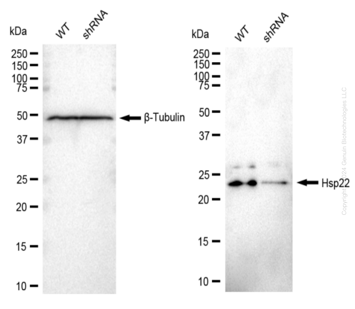 Hsp22 (HSPB8) Human Knockdown Lysate
