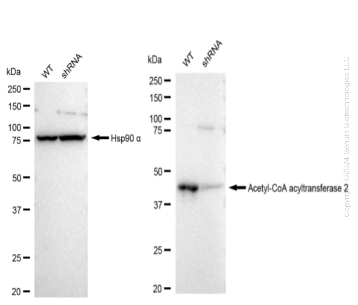 ACAA2 Human Knockdown Lysate