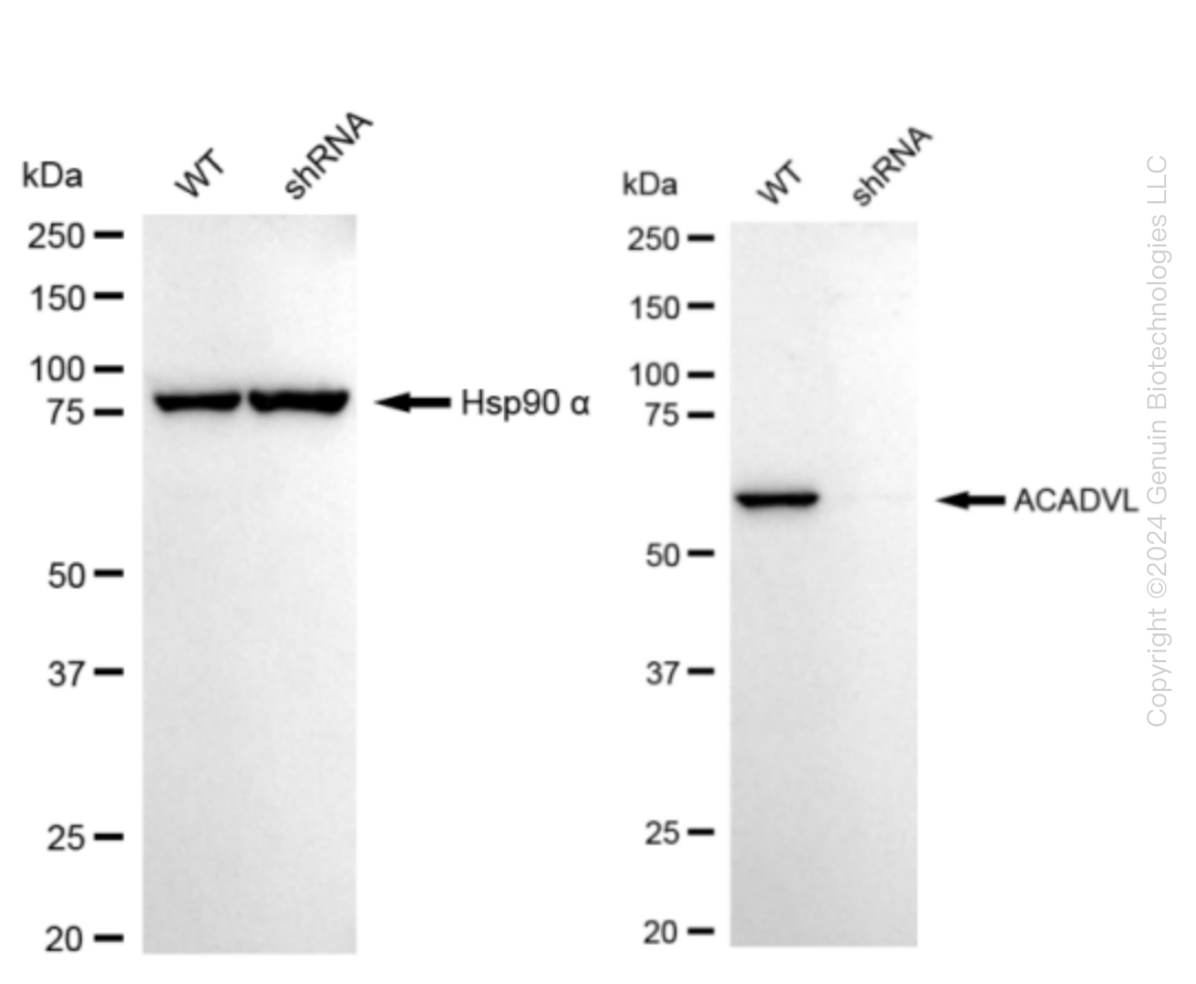 ACADVL Human Knockdown Lysate