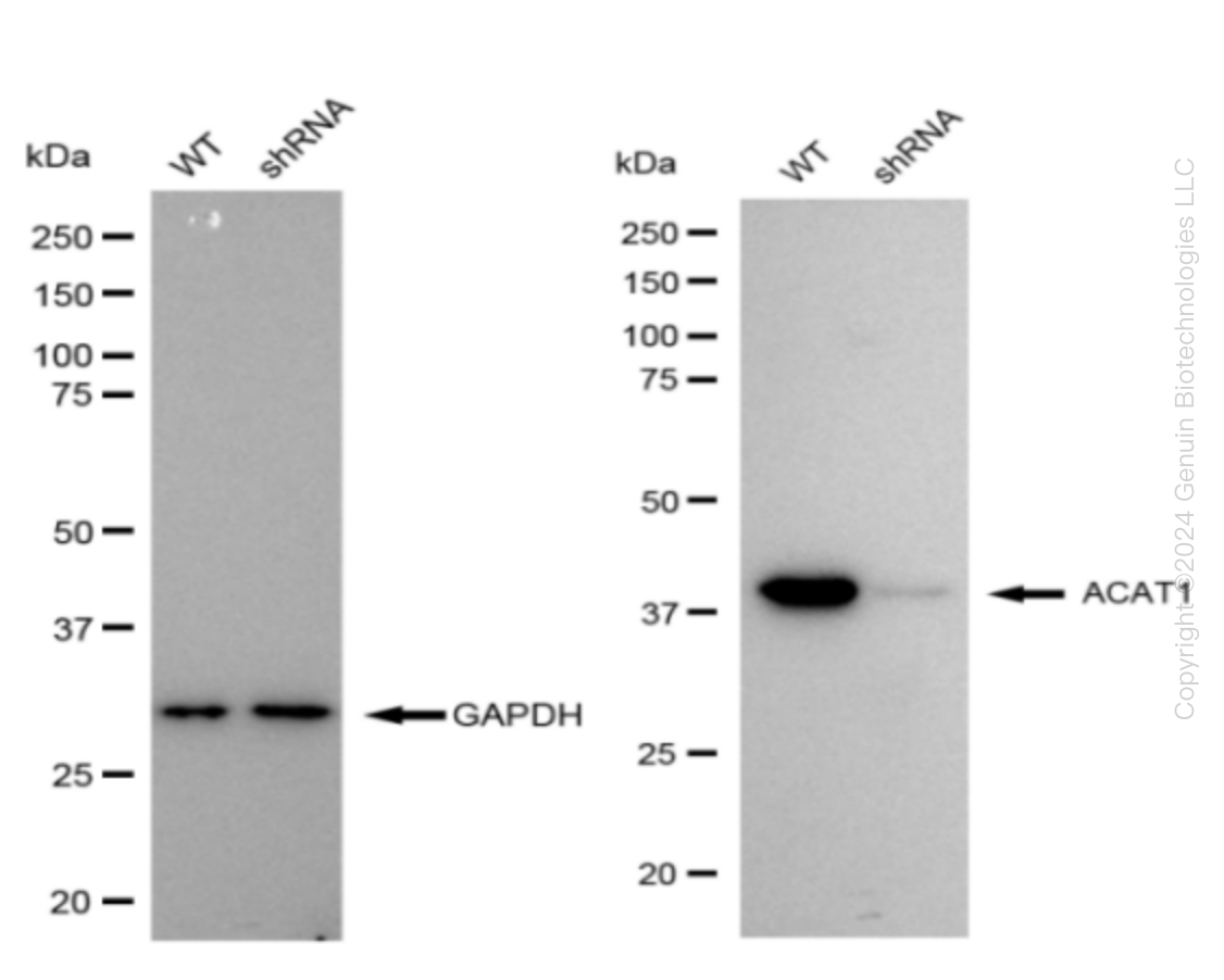 ACAT1 Human Knockdown Lysate