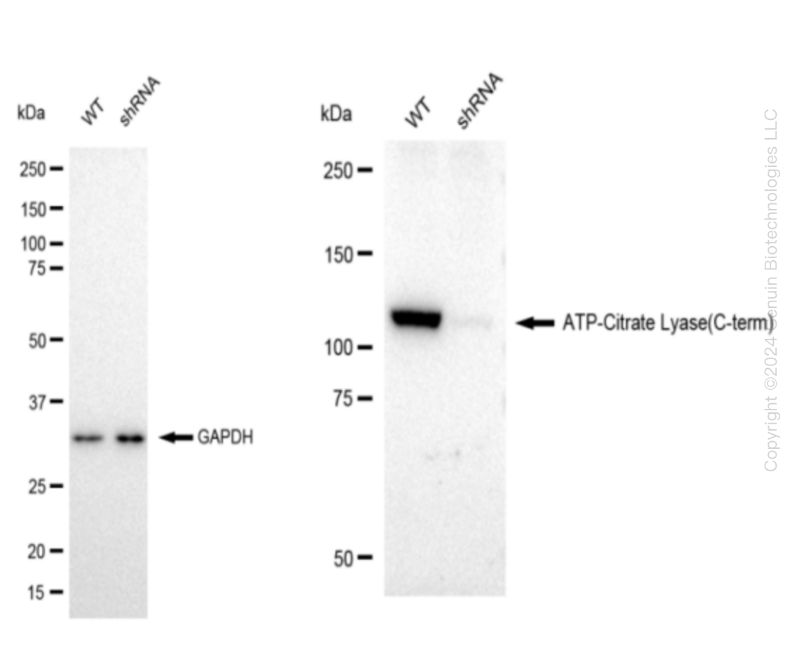 ATP citrate lyase (ACLY) Human Knockdown Lysate