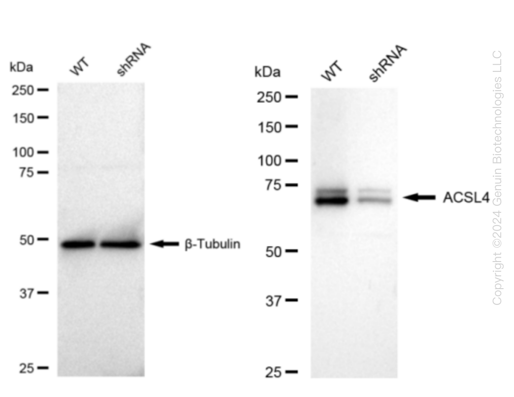 FACL4 (ACSL4) Human Knockdown Lysate
