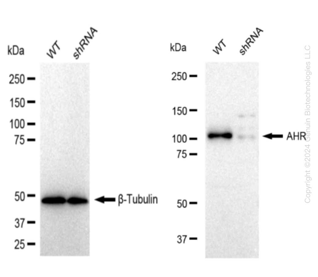 Aryl hydrocarbon Receptor (AHR) Human Knockdown Lysate