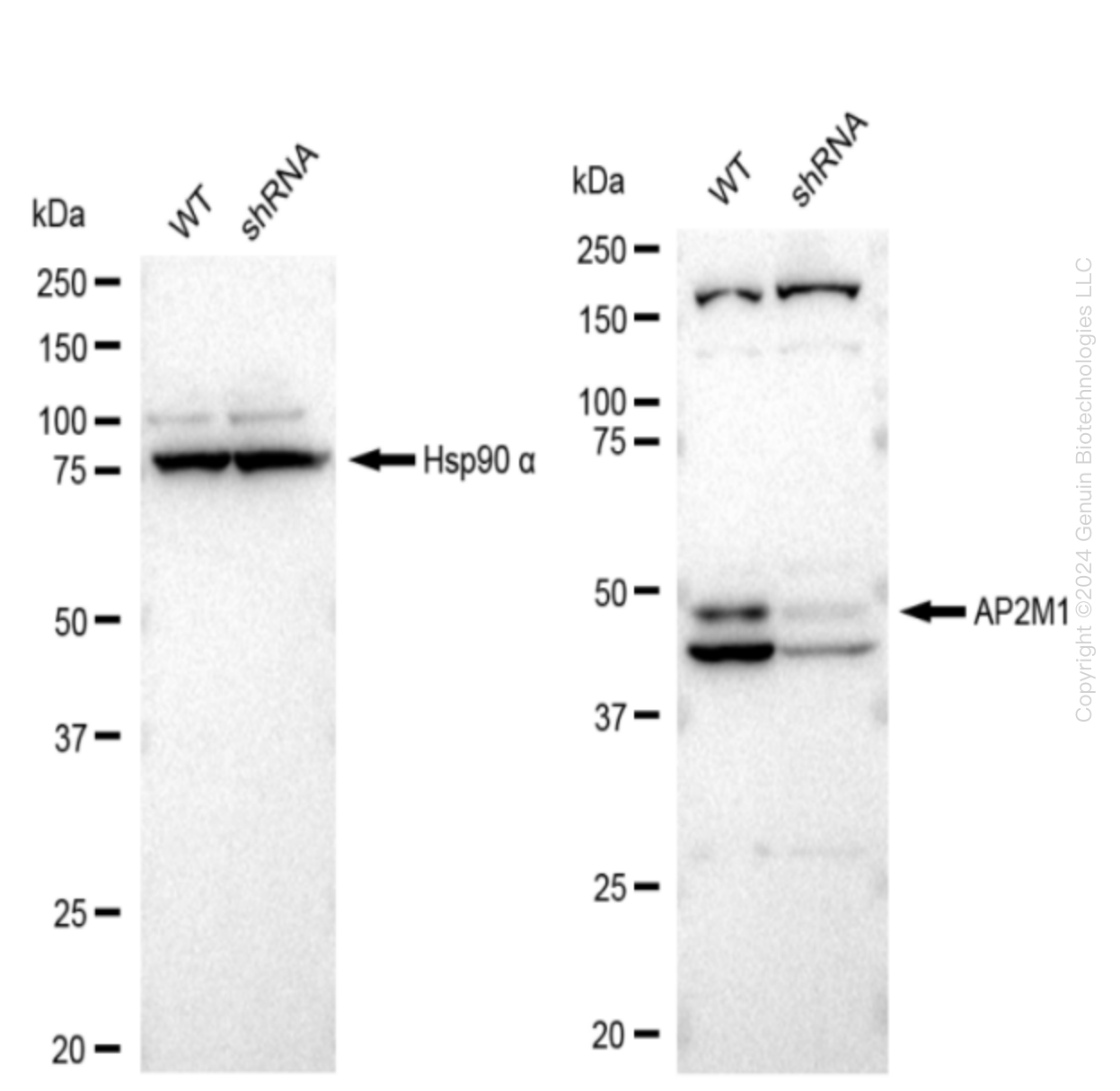 AP2M1 Human Knockdown Lysate
