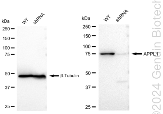 Western blotting analysis. APPL1 protein expression in wild-type (WT) and shRNA knockdown (KD) HeLa cells was detected using Western blotting. β-Tubulin served as a loading control. The blots were incubated with primary antibodies (Cat#61664, 1:5,000) against APPL1 and β-Tubulin, respectively, followed by incubating with HRP-conjugated goat anti-rabbit secondary antibody (Cat#201, 1:20,000). Images were developed using FeQ™ ECL Substrate Kit (Cat#226).