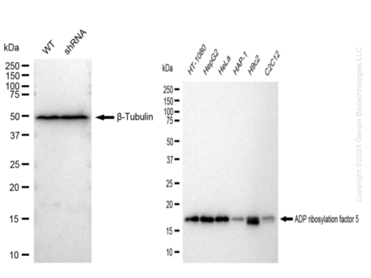 Western blotting analysis. ARF5 protein expression in wild-type (WT) and shRNA knockdown (KD) HeLa cells was detected using Western blotting.  β-Tubulin served as a loading control. The blots were incubated with primary antibodies (Cat#61457, 1:5,000) against ARF5 and β-Tubulin , respectively, followed by incubating with HRP-conjugated goat anti-rabbit secondary antibody (Cat#201, 1:20,000). Images were developed using FeQ™ ECL Substrate Kit (Cat#226).