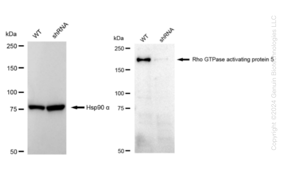 Western blotting analysis. ARHGAP5 protein expression in wild-type (WT) and shRNA knockdown (KD) HeLa cells was detected using Western blotting. Hsp90 α served as a loading control. The blots were incubated with primary antibodies against ARHGAP5 and Hsp90 α, respectively, followed by incubating with HRP-conjugated goat anti-rabbit secondary antibody. Images were developed using FeQ™ ECL Substrate Kit.