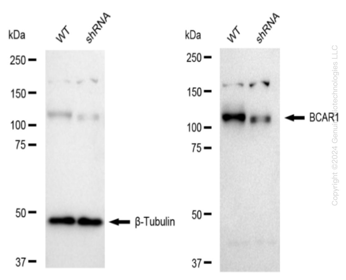 Western blotting analysis. BCAR1 protein expression in wild-type (WT) and shRNA knockdown (KD) HeLa cells was detected using Western blotting. β-Tubulin served as a loading control. The blots were incubated with primary antibodies against BCAR1 and β-Tubulin, respectively, followed by incubating with HRP-conjugated goat anti-rabbit secondary antibody. Images were developed using FeQ™ ECL Substrate Kit.