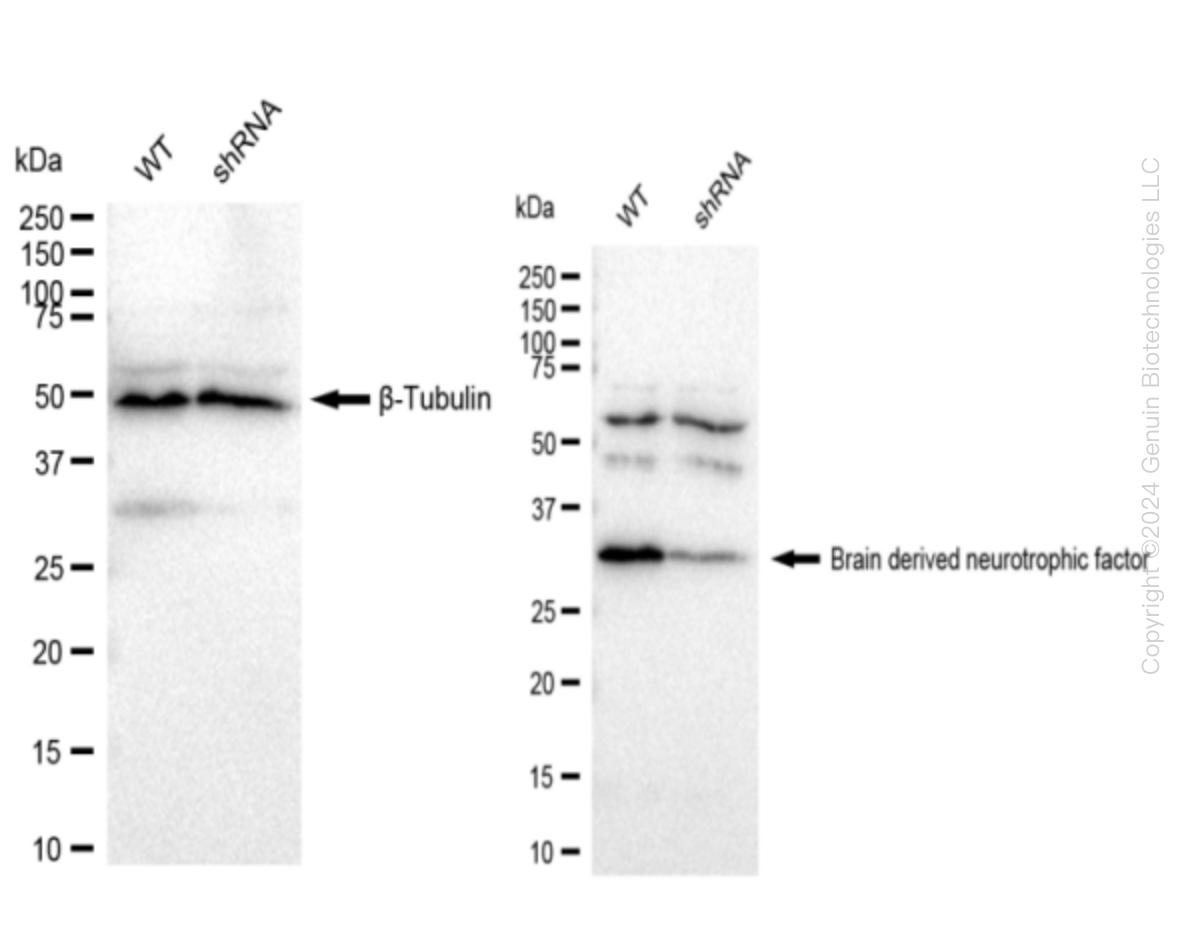 Western blotting analysis. BDNF protein expression in wild-type (WT) and shRNA knockdown (KD) HeLa cells was detected using Western blotting.  β-Tubulin served as a loading control. The blots were incubated with primary antibodies (Cat#69354, 1:5,000) against BDNF and β-Tubulin , respectively, followed by incubating with HRP-conjugated goat anti-rabbit secondary antibody (Cat#201, 1:20,000). Images were developed using FeQ™ ECL Substrate Kit (Cat#226).