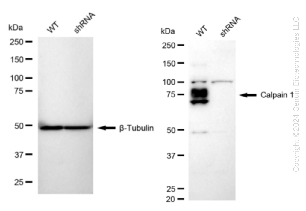 Western blotting analysis. CAPN1  protein expression in wild-type (WT) and shRNA knockdown (KD) HeLa cells was detected using Western blotting. β-Tubulin served as a loading control. The blots were incubated with primary antibodies against CAPN1 and β-Tubulin, respectively, followed by incubating with HRP-conjugated goat anti-rabbit secondary antibody. Images were developed using FeQ™ ECL Substrate Kit.