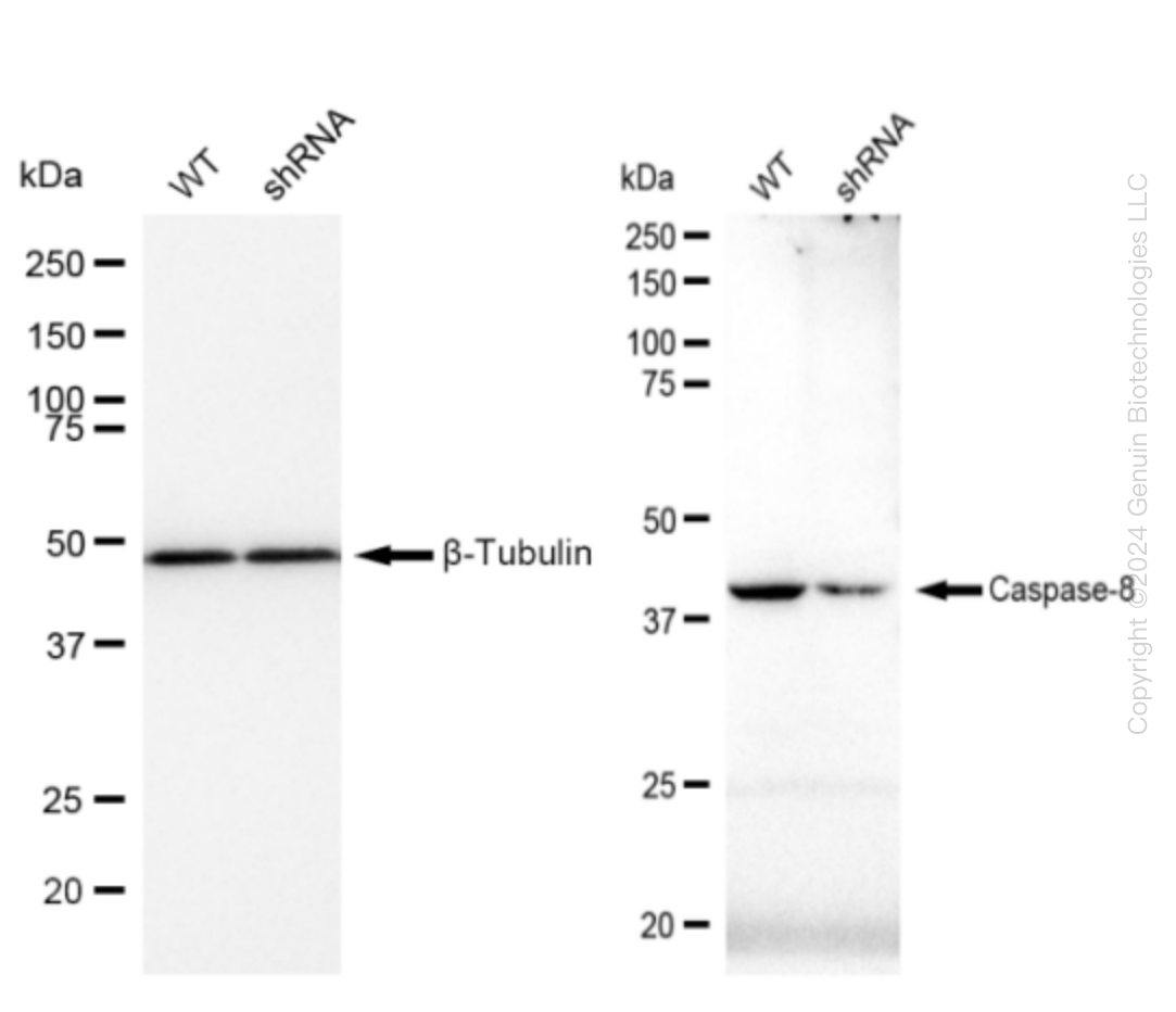 Caspase 8 (CASP8) Human Knockdown Lysate