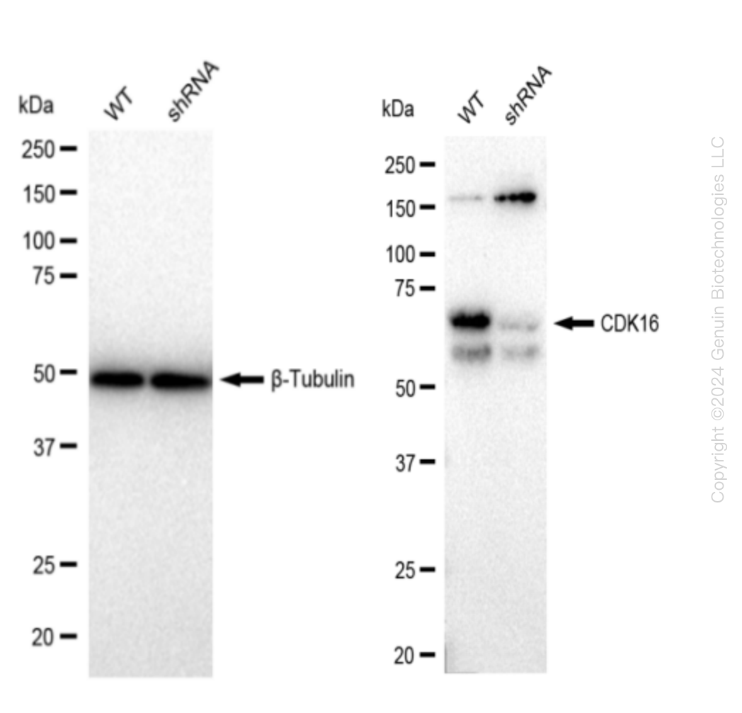 PCTAIRE1 (CDK16) Human Knockdown Lysate