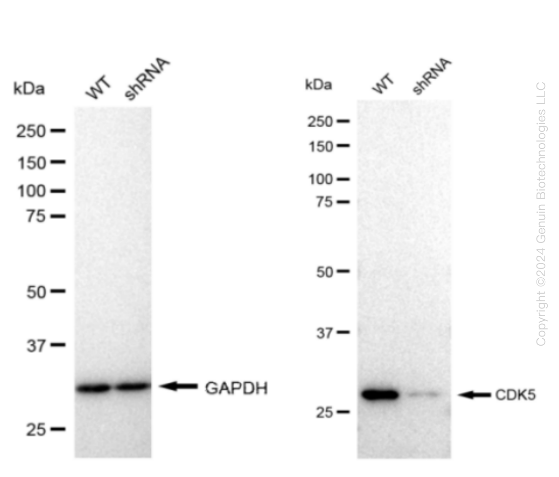 CDK5 Human Knockdown Lysate