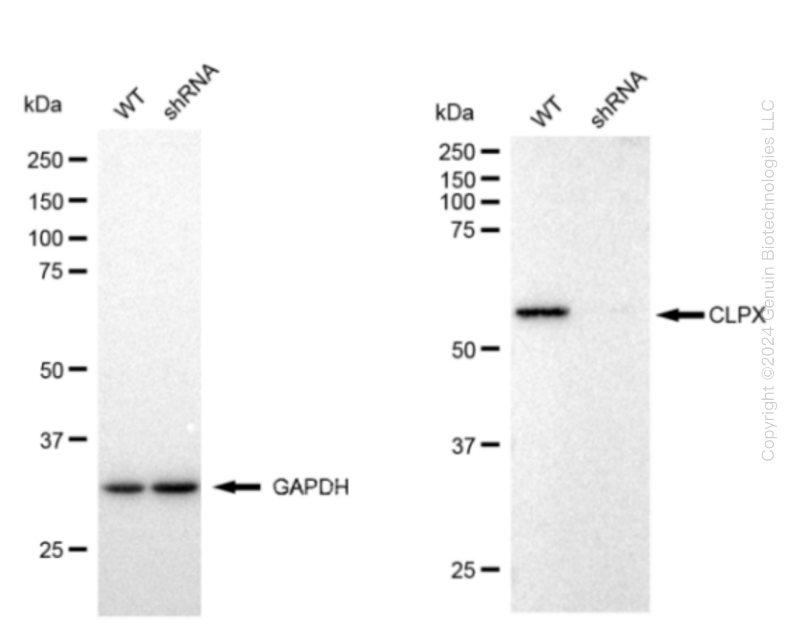 CLPX Human Knockdown Lysate