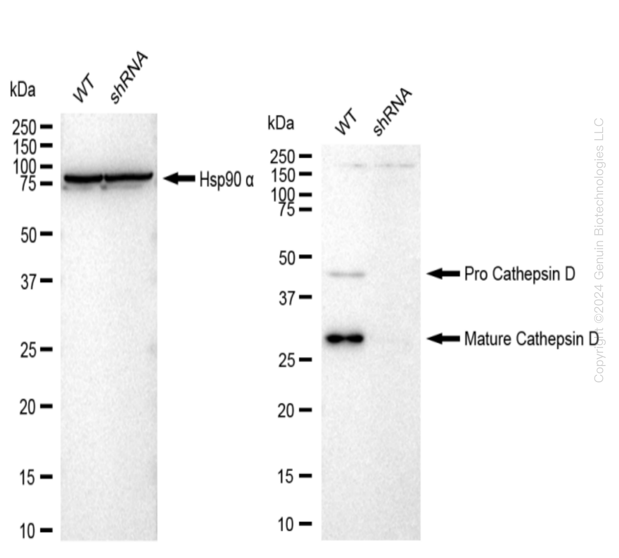 Cathepsin D (CTSD) Human Knockdown Lysate