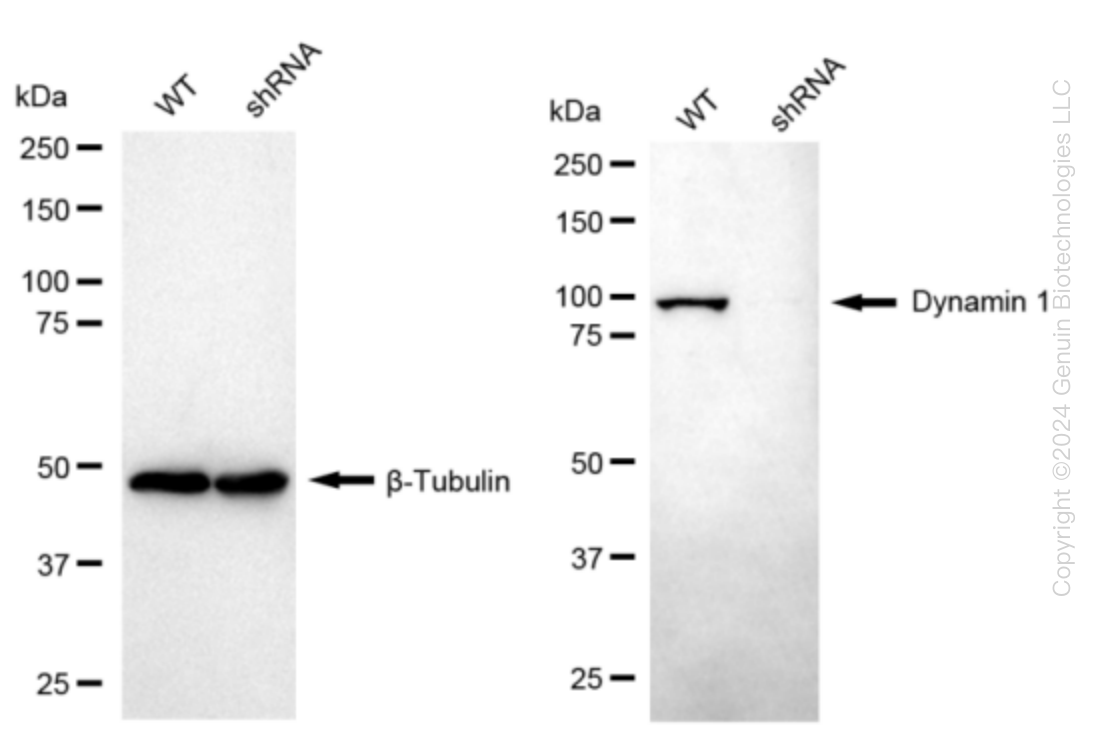 Dynamin 1 (DNM1) Human Knockdown Lysate