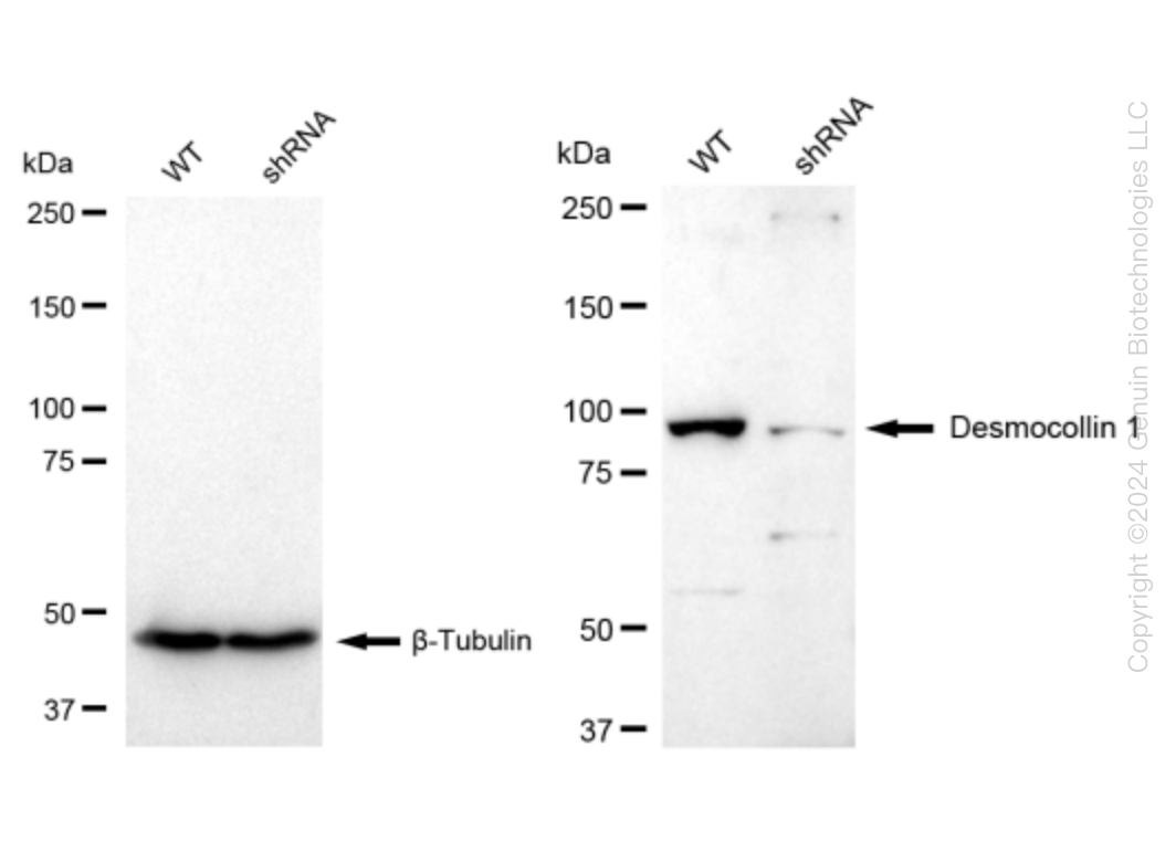 Desmocollin 1 (DSC1) Human Knockdown Lysate