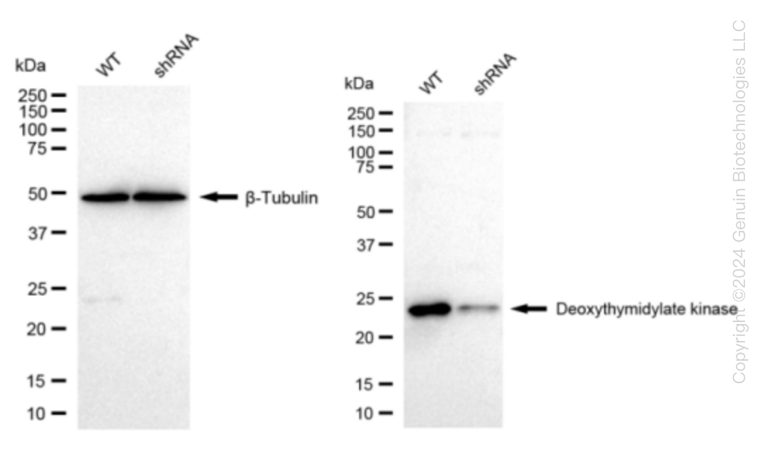 DTYMK Human Knockdown Lysate
