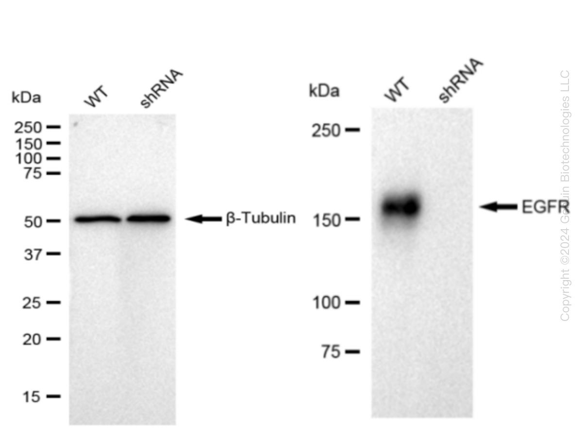EGFR Human Knockdown Lysate