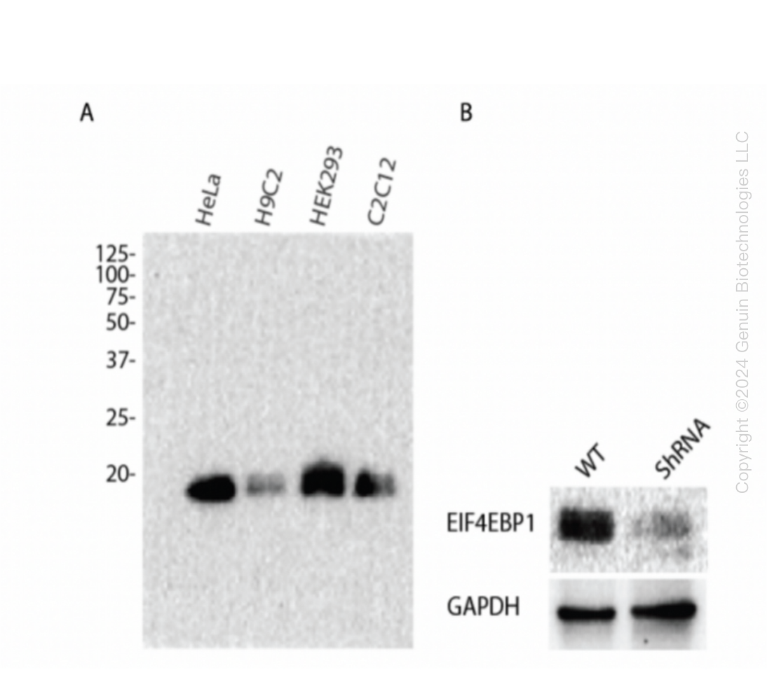 EIF4EBP1 Human Knockdown Lysate