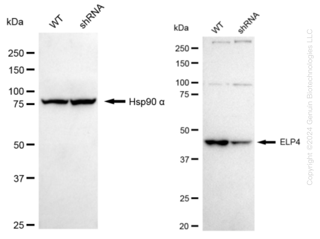 ELP4 Human Knockdown Lysate