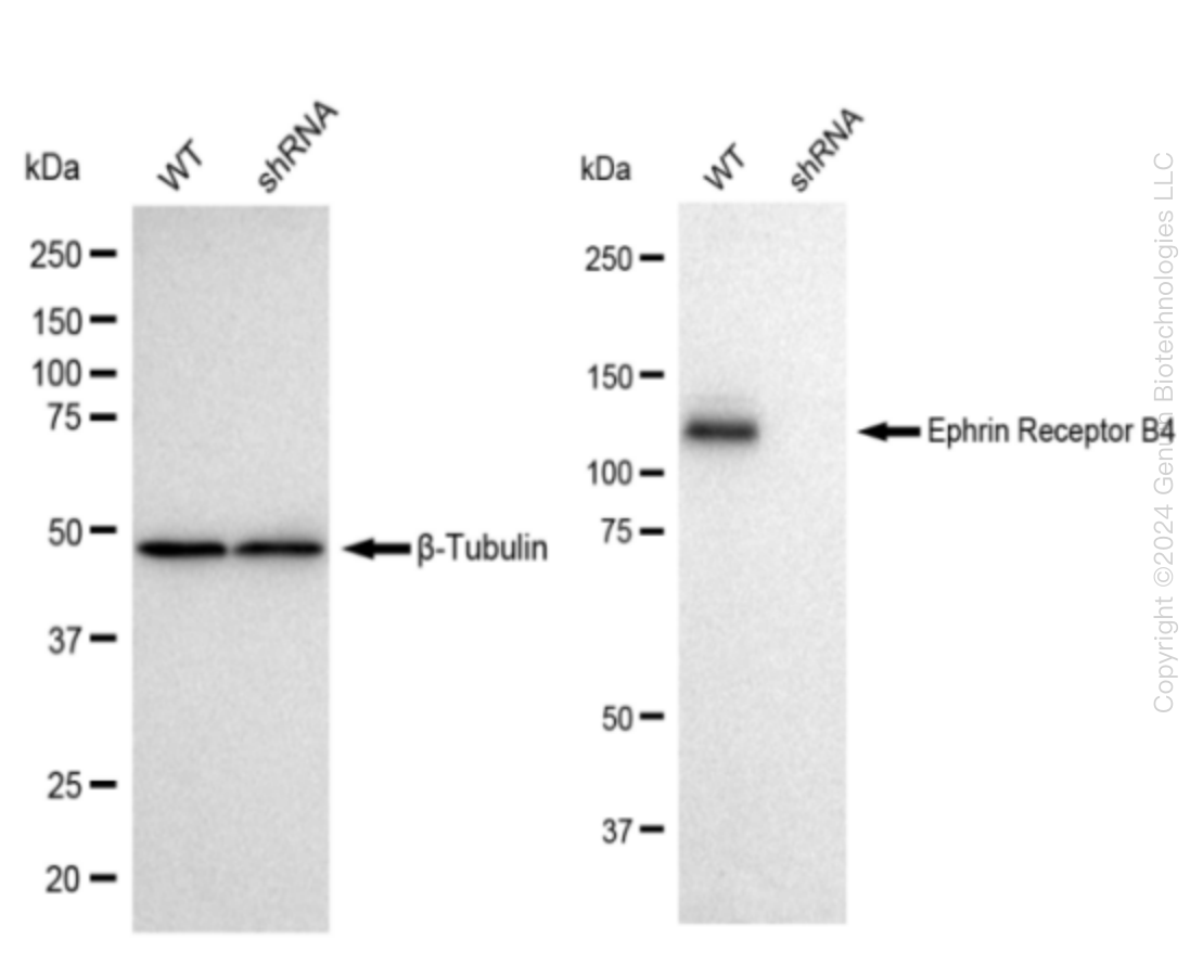 Eph receptor B4 (EPHB4) Human Knockdown Lysate