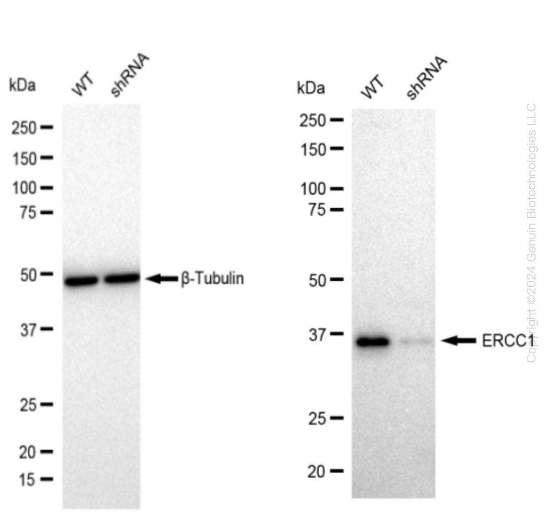 ERCC1 Human Knockdown Lysate