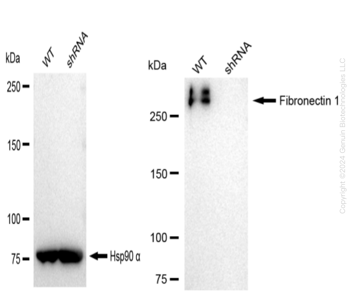 Fibronectin (FN1) Human Knockdown Lysate