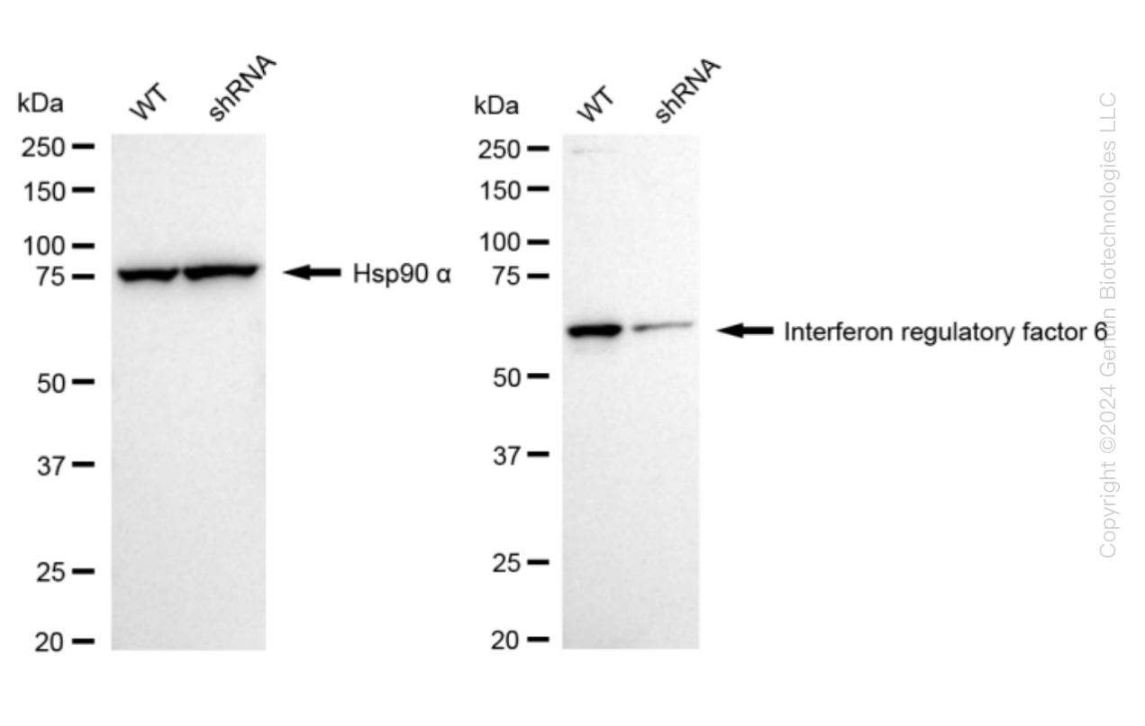 IRF6 Human Knockdown Lysate | LY300212 | OriGene Technologies Inc.