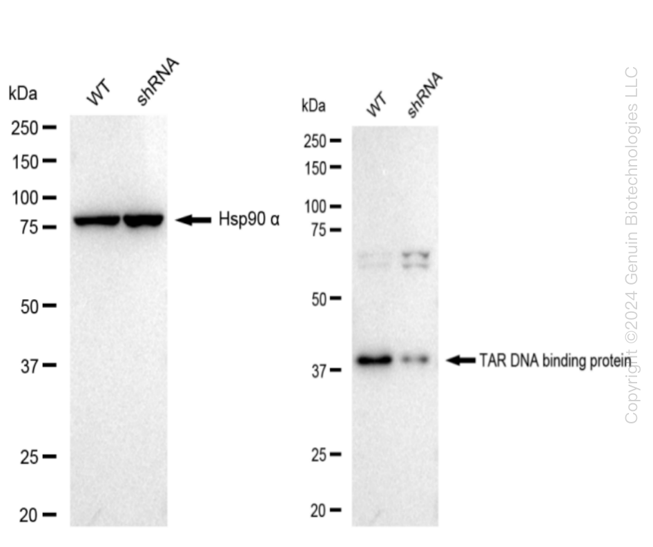 TDP43 (TARDBP) Human Knockdown Lysate