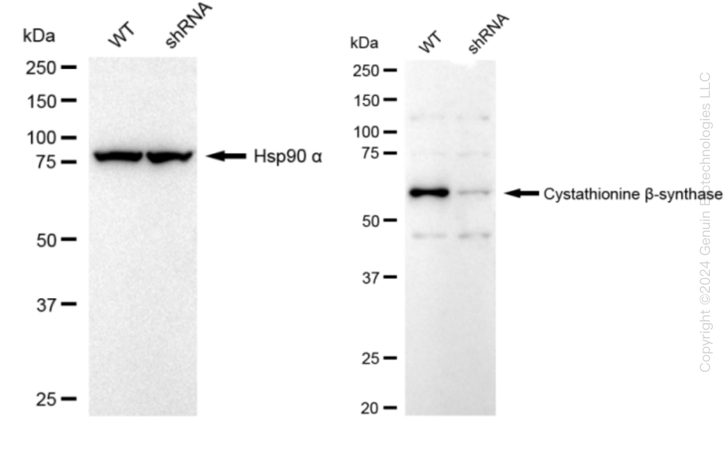 CBS Human Knockdown Lysate | OriGene Technologies Inc.