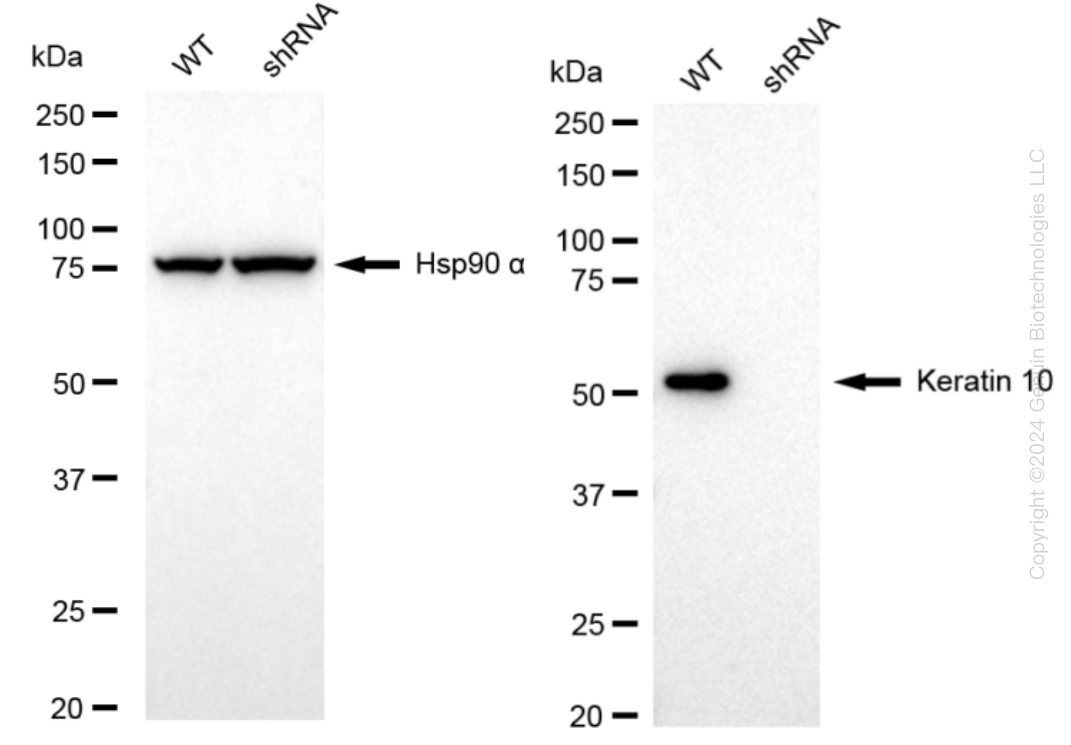 Cytokeratin 10 (KRT10) Human Knockdown Lysate | LY300359 | OriGene ...